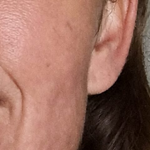 Brown Spots